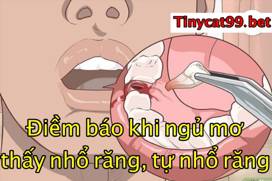 Mơ thấy nhổ răng, tự nhổ răng đánh con gì